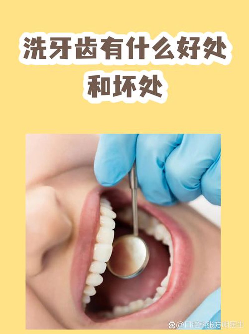 种植牙走进大众生活