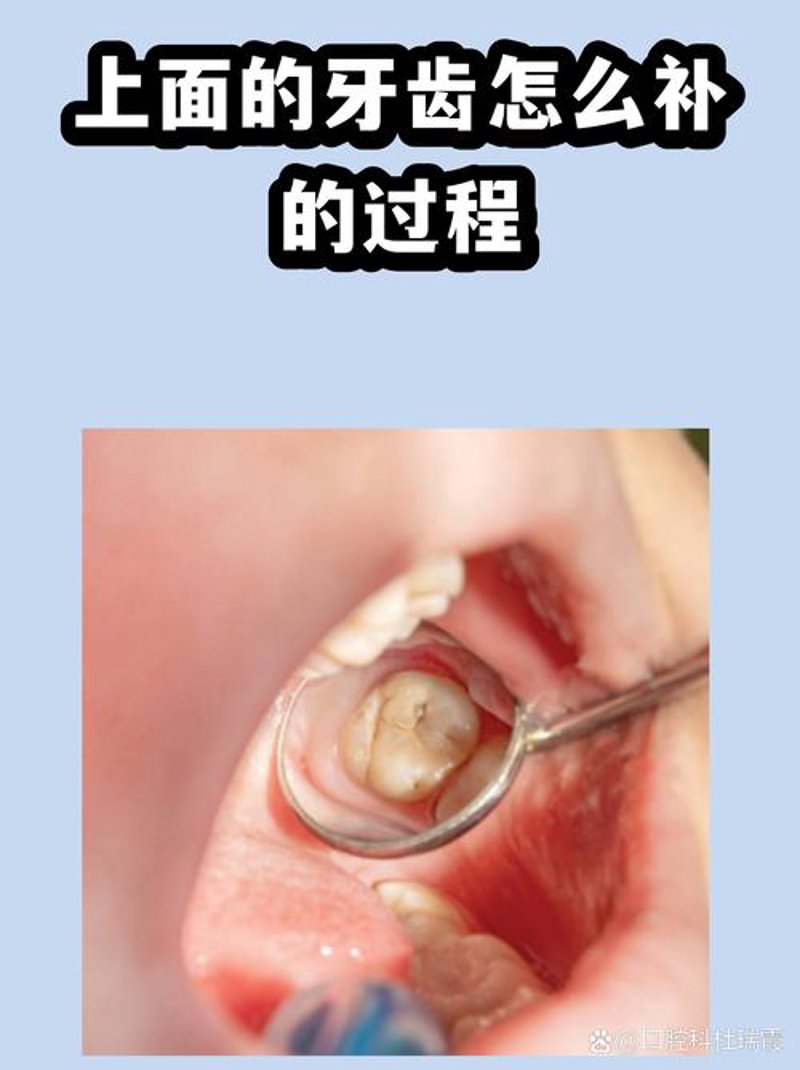 牙齿矫正新趋势：矫正不单是美观